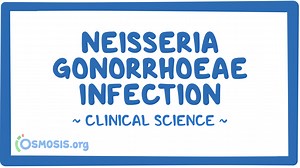 Neisseria gonorrhoeae infection: Video & Meaning | Osmosis