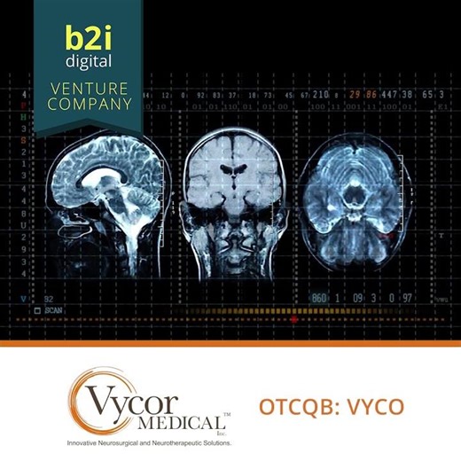 Vycor Medical, Inc. changes after a stroke can develop gradually and go unnoticed during recovery.