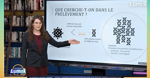Recherche de l’ARN du virus SARS-CoV2 par PCR