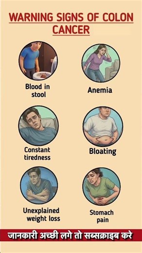 A Warning Signs of Colon Cancer You Should Never Ignore | Early SymptomsExplained #healthylifestyle