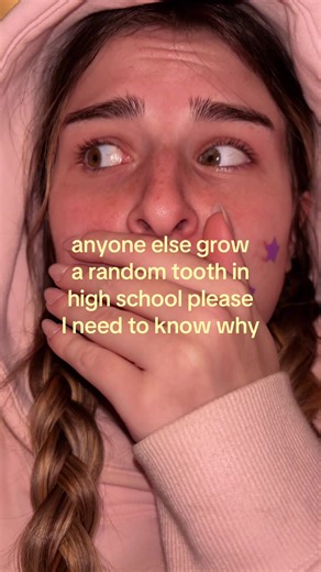 ignore my choppedness #xyzbca #teeth #viral #fyp | teething