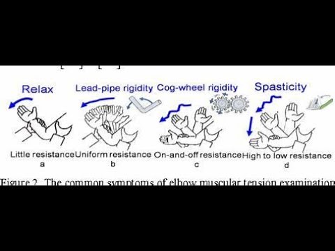 Difference between Cogwheel Rigidity and Lead Pipe Rigidity