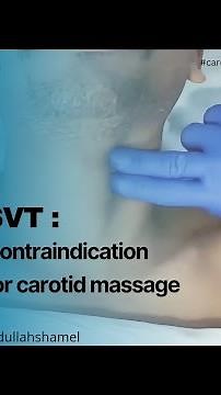 absolute Contraindication for carotid sinus massage , in SVT ( supra ventricular tachycardia )