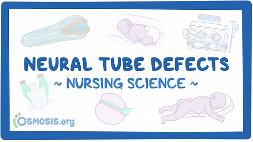 Neural tube defects: Nursing: Video & Causes | Osmosis