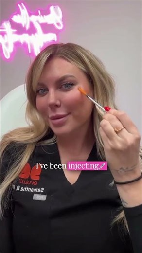 My dissolving process | Dissolved My Own Fillers 👀💉 | Sam Berry’s Story 👩‍⚕️