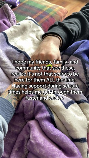 Understanding Focal Awareness Seizures and Their Impact