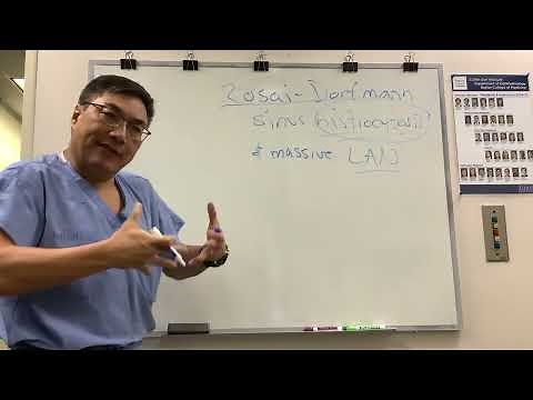 Rosai-Dorfman Syndrome (Sinus Histiocytosis)