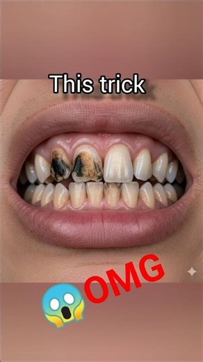 😱OMG Tooth Gel Benefits || Teeth glow 👈#toothgel