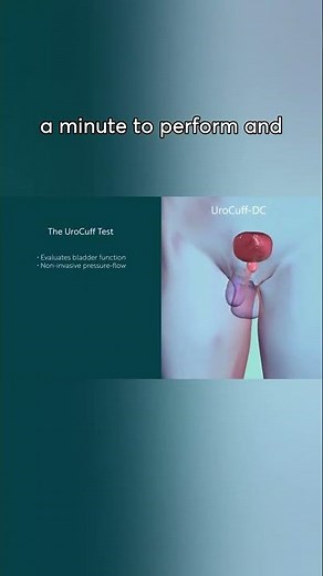 The Nuts and Bolts of UroCuff