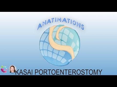 Kasai Portoenterostomy Anatimation