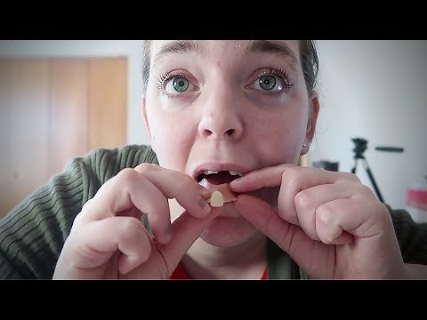 MY DEAD TOOTH | HOW I CARE FOR MY FLIPPER