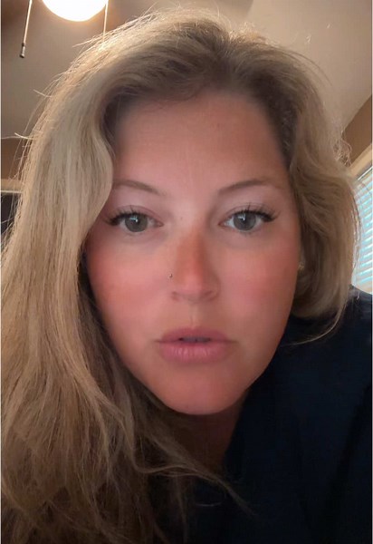 ¿Qué son los 'little boo boos'? Entiende la nueva moda