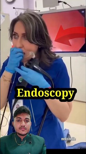 Endoscopy #endoscopy #gastriculcer #endoscopicprocedure #doctor