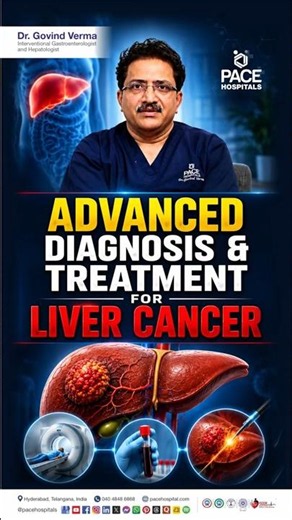 How Liver Cancer Is Diagnosed & Treated? | Liver Cancer Advanced Screening & Treatment