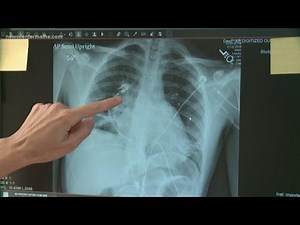 Identifying vaping Symptoms