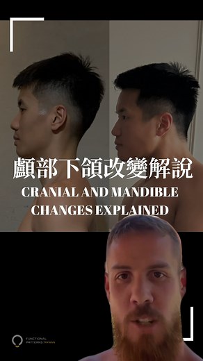 Functional Patterns台灣 on Instagram: "這是對“科學”的回應。@functionalpatterns 有哪些研究證明它可以幫助重塑和重建顱骨？這些研究終將出現，讓懷疑者無話可說。現在，這裡有一個實例，展示了一個人在你眼前實際改變了他的身體結構。👀 這些變化是專注於整個身體，而不僅僅是下巴的結果。 來自@fp.taiwan 的@danny.hung_ 展示了我們的客戶和從業者即將迎來的突破。他最近完成了我們的《人體生物力學專家4》課程，並在肌肉發展方面取得了顯著進步。 細胞分化這種現象，生物力學對其有著極大的影響。細胞的內外機械特性在控制幹細胞功能和發展方向上扮演著重要角色。最新的幹細胞生物學證據顯示，外部機械信號，如細胞外基質的黏彈性和表面結構，會影響幹細胞行為的多個方面，包括自我更新和分化。 這意味著，如果你能從根本上理解什麼是功能性運動，就能引導人類朝著應有的方向發展，搭建我們DNA的框架。那麼接下來會發生什麼？ 是現代科學無法想像的最佳健康狀態，而且只需最低的維護。我們可能需要50年才能真正了解把身體當作一個整體來訓練的深遠影響。到那時，人們會