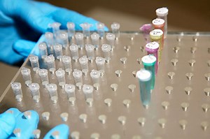 Validación, Incertidumbre y Control de Calidad en Laboratorios Microbiológicos