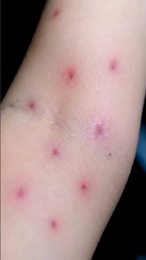 Skin rash #medical #medical terminology #science #knowledge