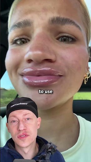Lip Filler GONE WRONG! | Plastic Surgeon Reacts