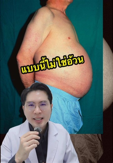 ดื่มหนักและเริ่มอ้วน อย่าลืมตรวจตับ #ตรวจสุขภาพ #ตับ #สุขภาพดี #อ้วน #tiktokuni