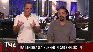 Jay Leno Seriously Burned in Car Fire