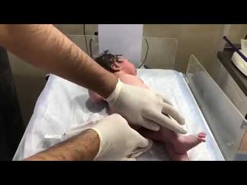 Newborn Baby Abdominal Distension How to Insert Suppository Safely NICU Education #shorts#shortvideo