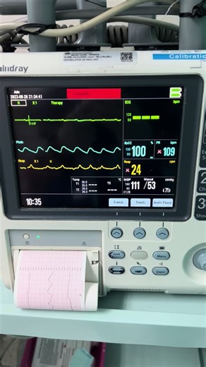 #asystole #trick #oxygen #pulse #BP