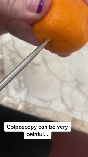 Understanding Coloscopy: A Visual Guide