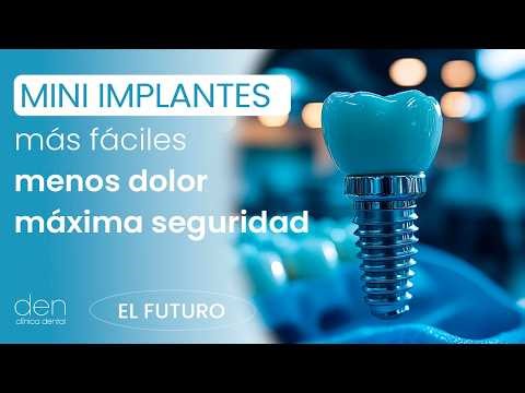MINI IMPLANTES en ORTODONCIA ➡️ qué son, para qué sirven cuándo se UTILIZAN✨(explicado en 1 min)