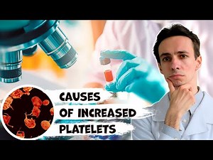High blood platelets. What are the causes and what to do. Doctor gives hints