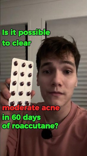 Day 1/60: Roaccutane (progressmaxxing)
