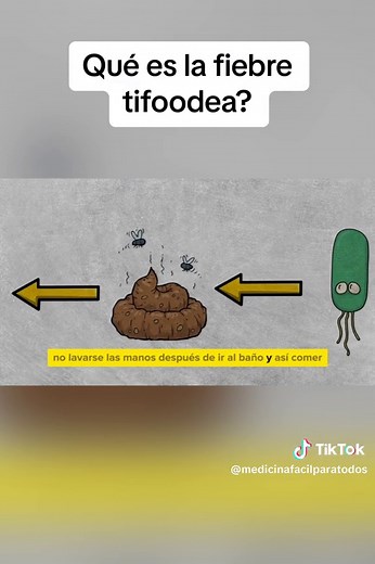 ¿Qué es la fiebre tifoidea y cómo prevenirla?