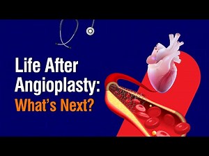 Life After Angioplasty: What’s Next? | Dr. Praneeth Polamuri