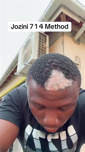 Master the Jozini 714 Method for Successful Copy Trading