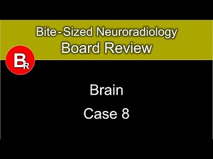 Neuroradiology Board Review - Brain Case 8