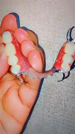 Dental Square on Instagram: "A CC (Cobalt-Chromium) plate denture is recommended for patients who need a strong, comfortable, and long-lasting removable partial denture. ✅ Suitable for patients who: • Have multiple missing teeth • Still have healthy natural teeth for support • Want a thin, comfortable, and stable denture • Need a long-term solution rather than a temporary one • Maintain good oral hygiene • Prefer a denture that feels lighter and more natural ✨ Designed for strength, precision, a