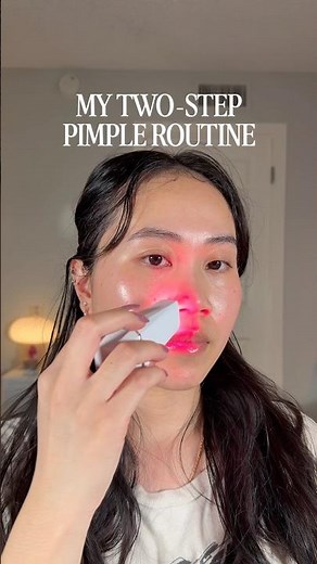 THIS 2-step routine gives me hope for those deep pimples like this one 😂🥹 #acneproneskin #skincare