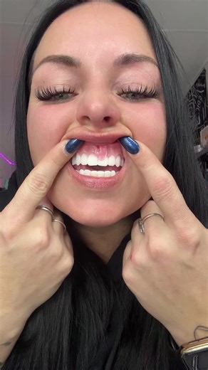 Trimming Denttach from my top Denture #denturejourney #dentures #denturegang #dentureconfidence #toothless #to0thlessqueen #teeth #denturesatayoungage #denturesmile #journey #howto #tutorial #learn #stigma #confidence #confident #denttach @Denttach