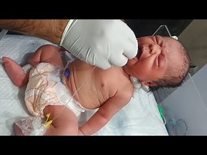 Newborn Baby Deep Suction & RBS Check-Up | Warmer Care & NICU Education