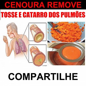 Cenoura Remove Tosse e Catarro dos Pulmões 🔥Dr. Rodolfo revela como emagrecer de 5 a 10 KG de gordura corporal em 21 dias, sem remédios e dietas malucas. Veja aqui 👉 http://emagrecimentorevelado.com.br/dieta ( click no link acima ☝️ ) | Dieta e Detox