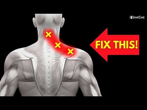How to INSTANTLY Fix a Pinched Nerve in Your Neck