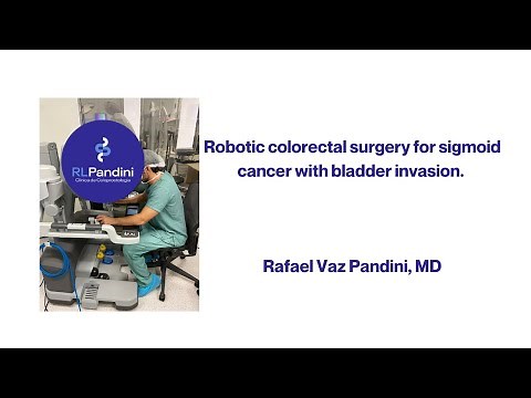 Robotic colorectal surgery for sigmoid cancer with bladder invasion.