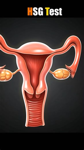 3D Animation ｜ HSG Test Procedure #doctor #documentaryphotography #DoctorWho #reel # shorts #DoctorWh#doctor | SMART Doctor