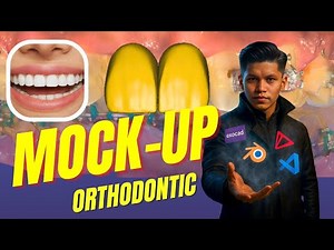 Orthodontic Mock-Up for Teeth 11–21 | Exocad Smile Design Tutorial | Ratanician