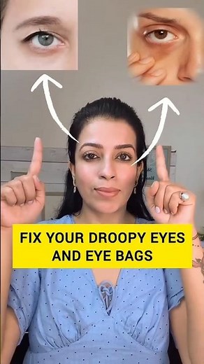 Fix Droopy Eyes & Eye Bags Naturally! ✨👁️ #FaceYoga #EyeCare #BeautyTips