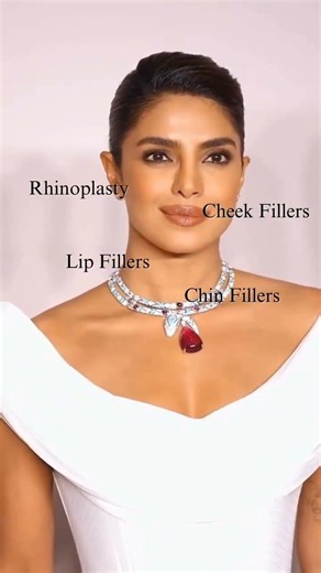 How to Get a Lifted Face Without Surgery ✨ | Celebrity-Inspired Look