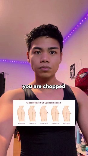 you are chopped if your chest looks like this... #gyno #gynecomastia #maxxteem