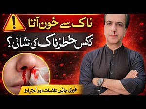 BLEEDING FROM NOSE CAUSES AND TREATMENT.