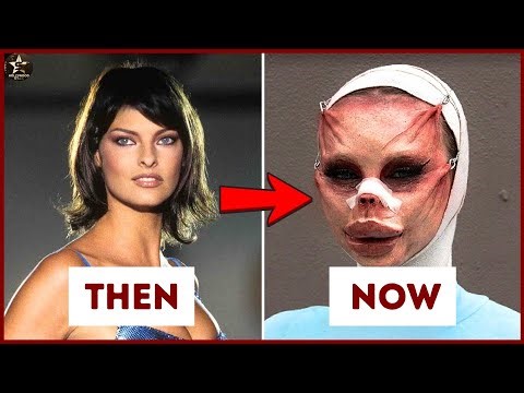 10 Celebrities Who Destroyed Their Looks With Plastic Surgery — See Their Shocking Transformations!