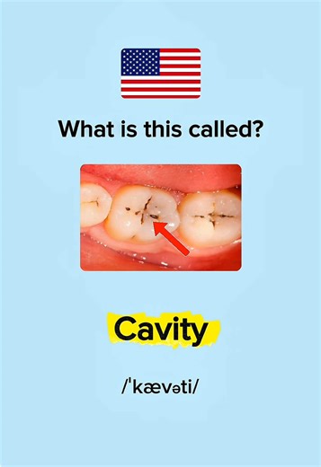Essential Dental Vocabulary for English Learners